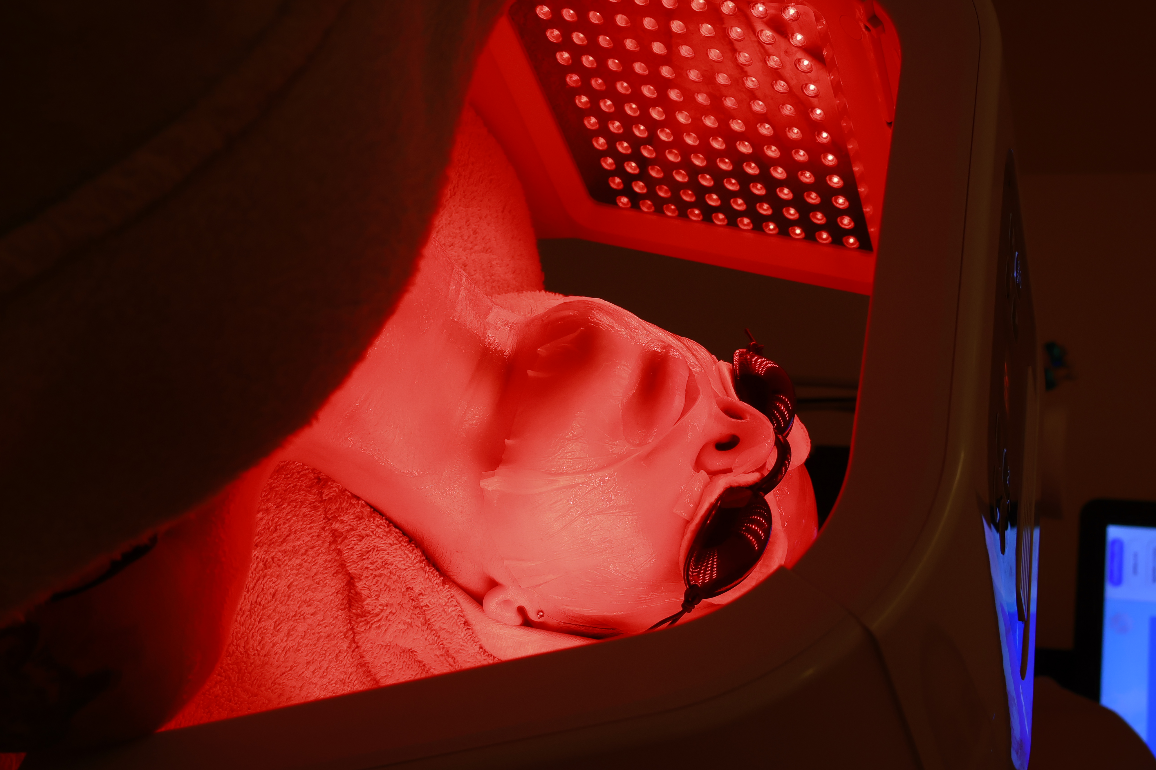 Tratamiento VitalEyes Holaglow